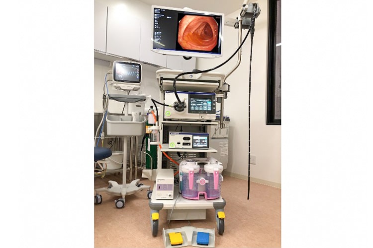 内視鏡システム